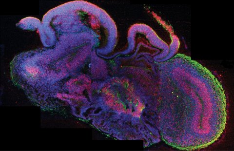 Querschnitt eines vollständigen zerebralen Organoids © IMBA / Madeline Lancaster