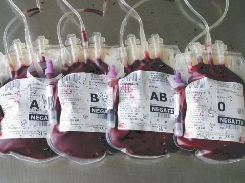 Blutbeutel, nach der Spende, verschiedene Blutgruppen